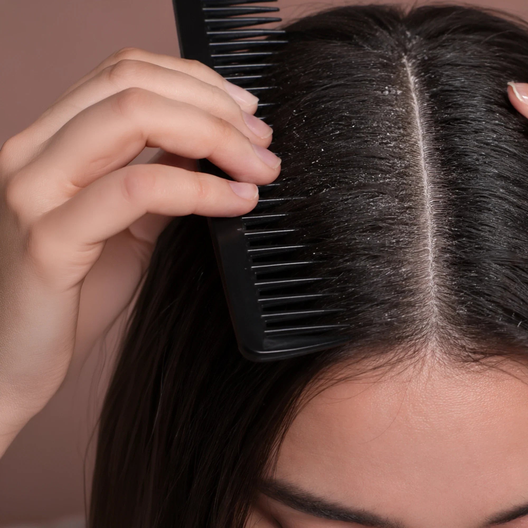 Dry Scalp