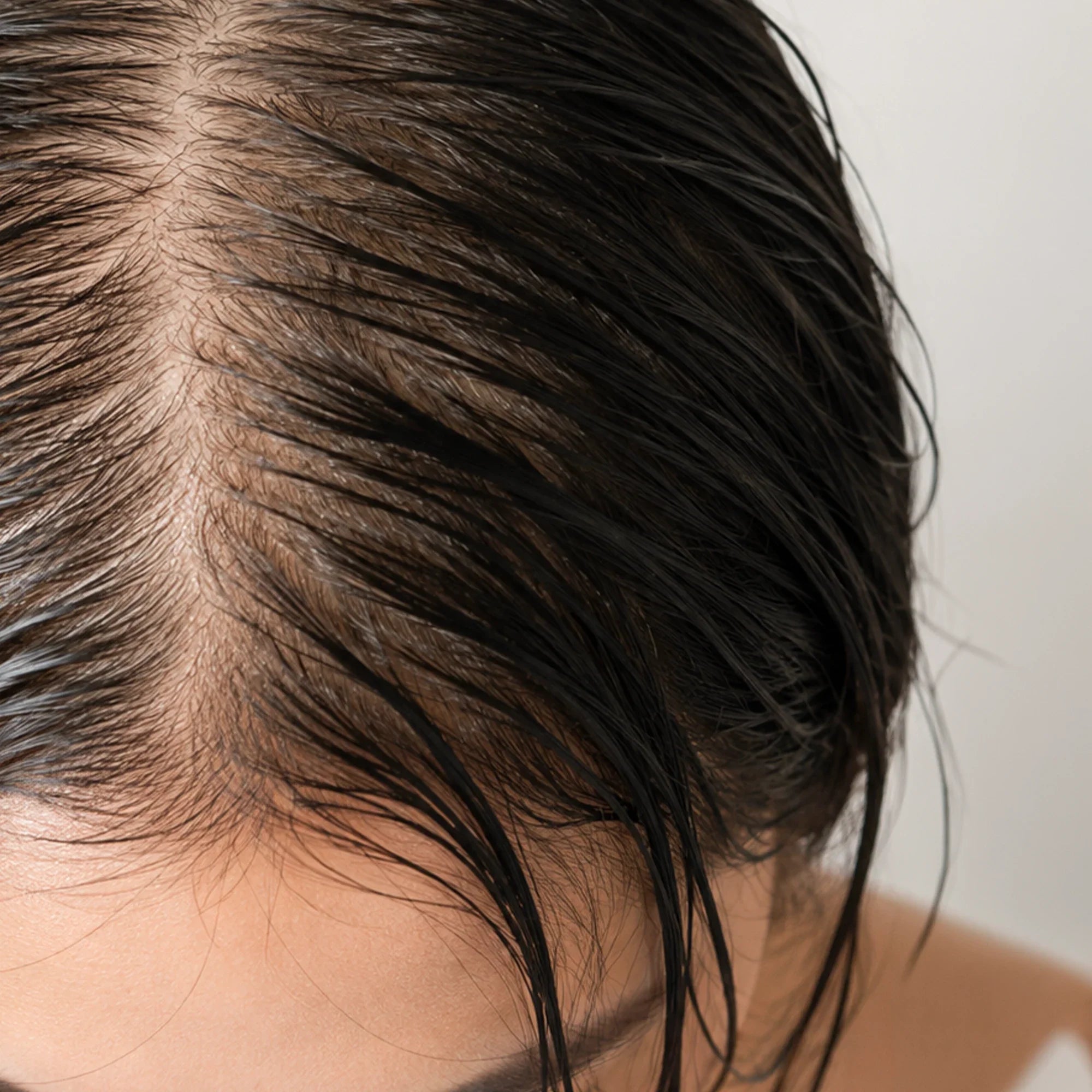 Oily Scalp