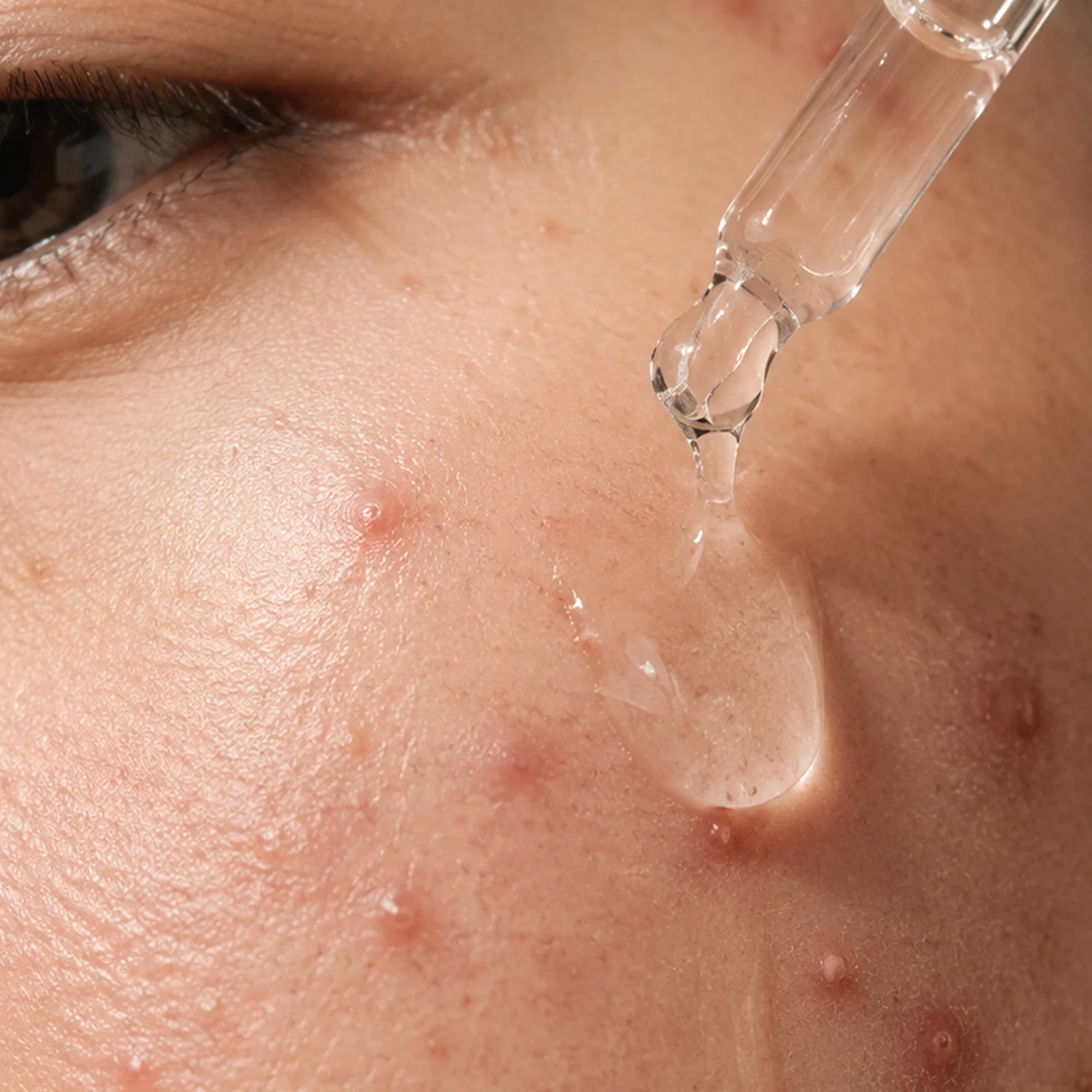 Sensitivity - Kanpeki Skincare