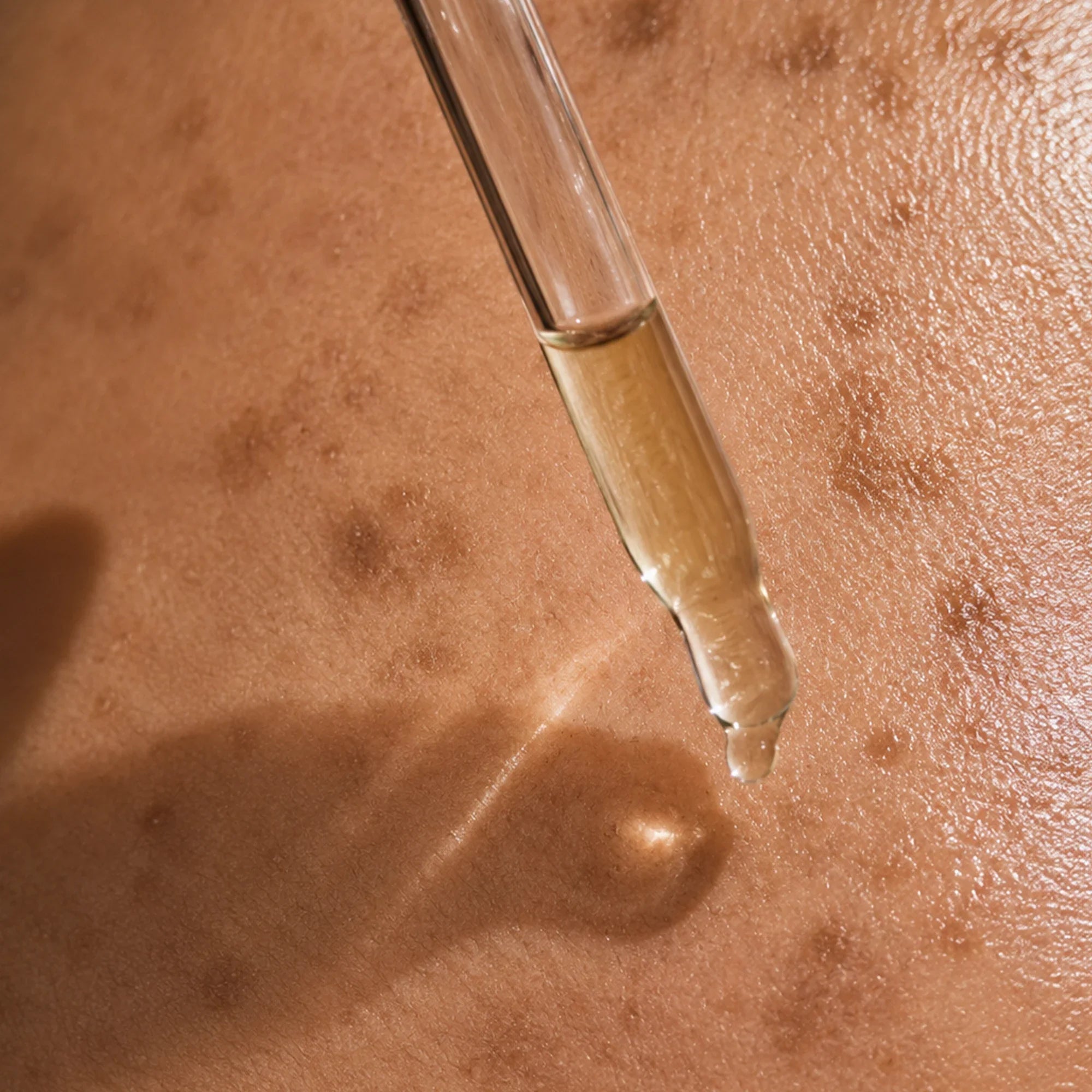 Hyperpigmentation - Kanpeki Skincare